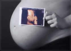 phinephoto-berlin-babybauch-ultraschallbild